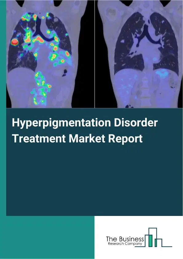 Global Hyperpigmentation Disorder Treatment Market Report 2026 Global Hyperpigmentation Disorder Treatment Market Report 2026