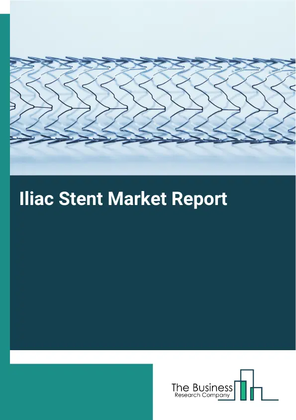 Global Iliac Stent Market Report 2026 Global Iliac Stent Market Report 2026