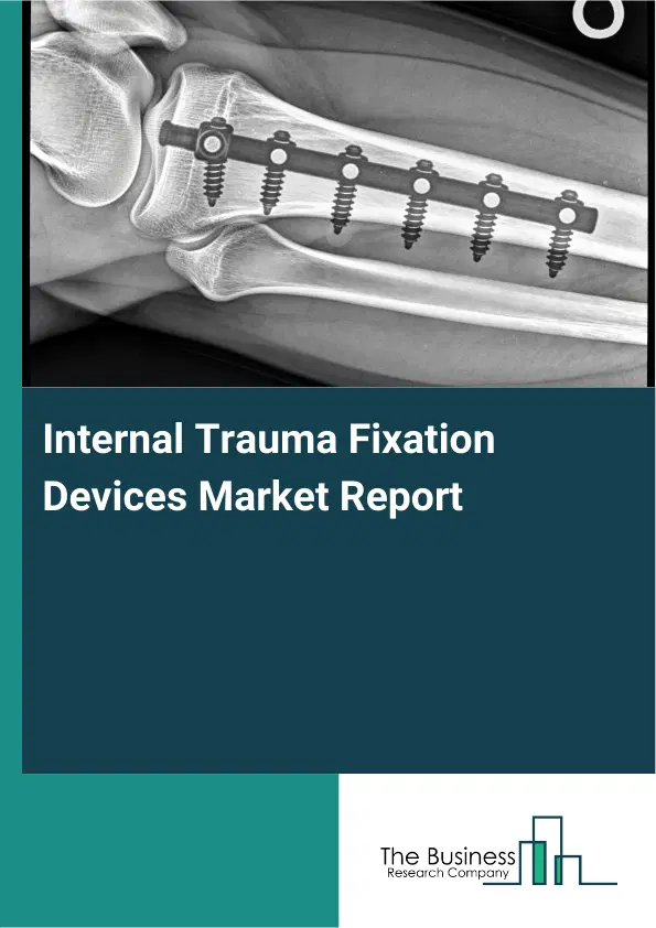 Global Internal Trauma Fixation Devices Market Report 2026 Global Internal Trauma Fixation Devices Market Report 2026