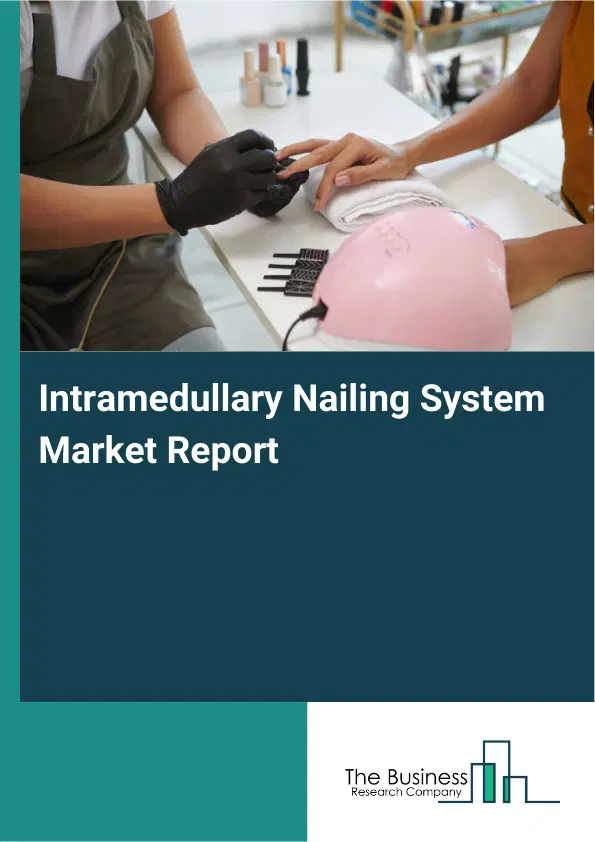 Global Intramedullary Nailing System Market Report 2026 Global Intramedullary Nailing System Market Report 2026