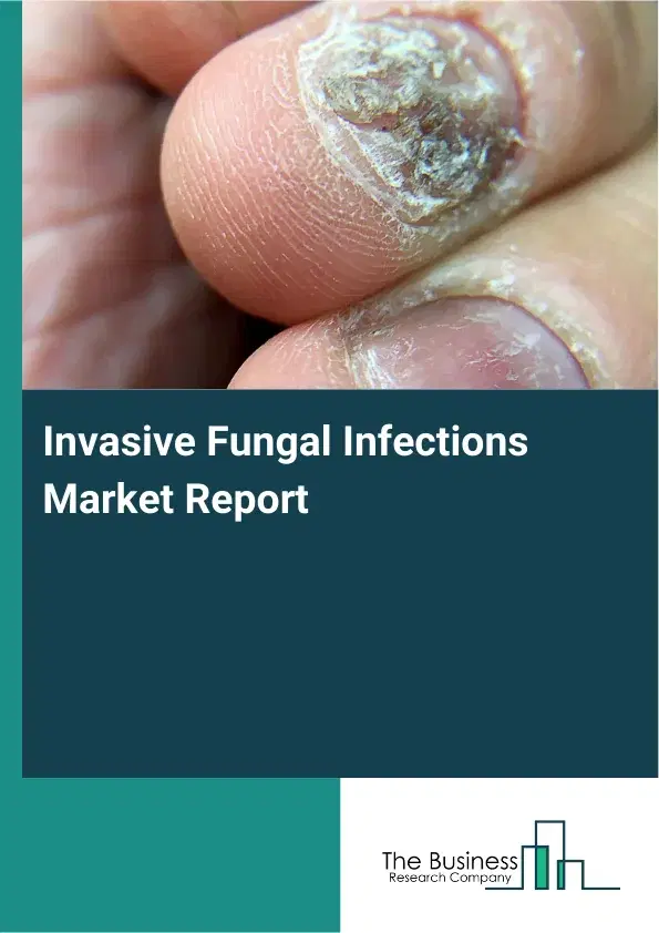 Global Invasive Fungal Infections Market Report 2026 Global Invasive Fungal Infections Market Report 2026