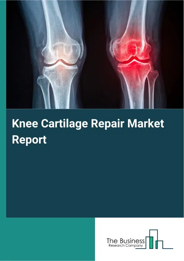 Global Knee Cartilage Repair Market Report 2026 Global Knee Cartilage Repair Market Report 2026