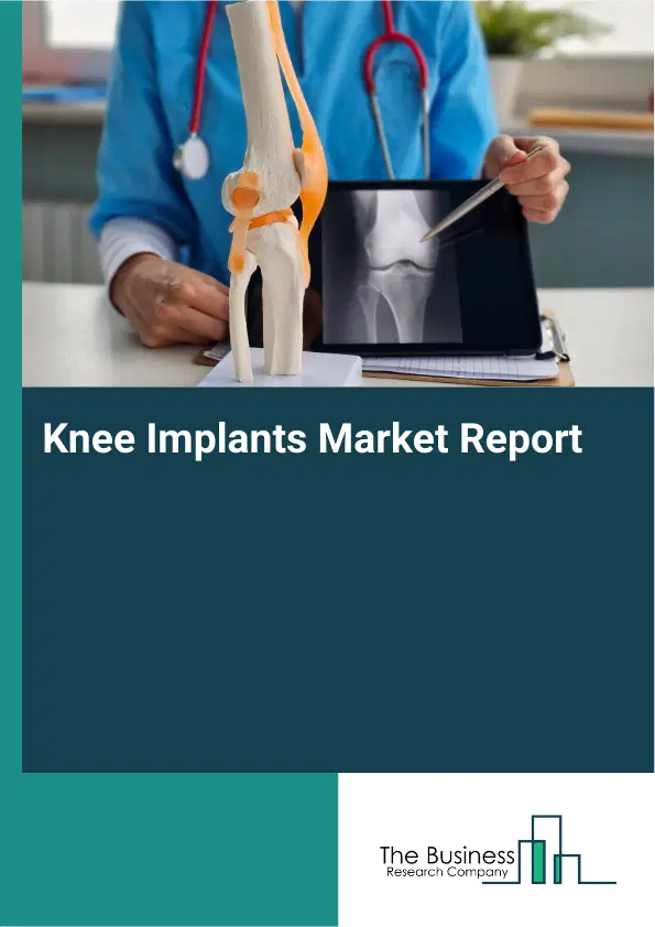 Global Knee Implants Market Report 2026 Global Knee Implants Market Report 2026