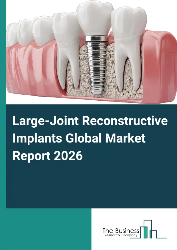 Large-Joint Reconstructive Implants Market Report 2026 Large-Joint Reconstructive Implants Market Report 2026