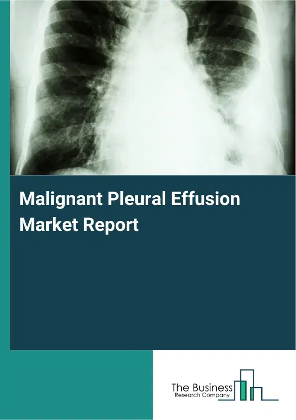 Global Malignant Pleural Effusion Market Report 2026 Global Malignant Pleural Effusion Market Report 2026