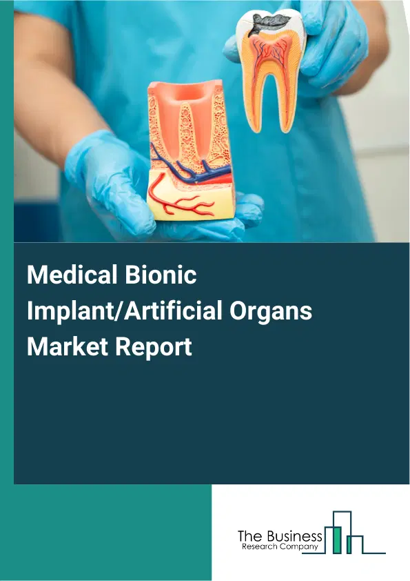 Global Medical Bionic Implant/Artificial Organs Market Report 2026 Global Medical Bionic Implant/Artificial Organs Market Report 2026