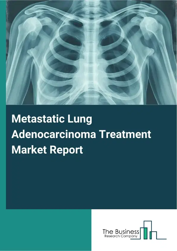 Global Metastatic Lung Adenocarcinoma Treatment Market Report 2026 Global Metastatic Lung Adenocarcinoma Treatment Market Report 2026