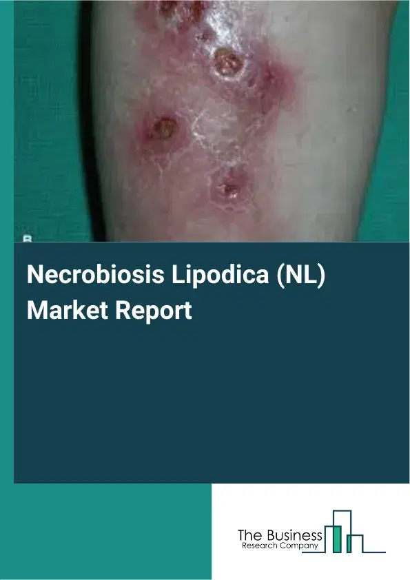 Global Necrobiosis Lipodica (NL) Market Report 2026 Global Necrobiosis Lipodica (NL) Market Report 2026