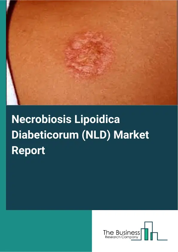 Global Necrobiosis Lipoidica Diabeticorum (NLD) Market Report 2026 Global Necrobiosis Lipoidica Diabeticorum (NLD) Market Report 2026