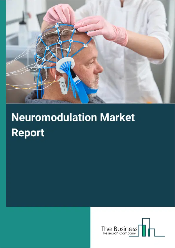 Global Neuromodulation Market Report 2026 Global Neuromodulation Market Report 2026