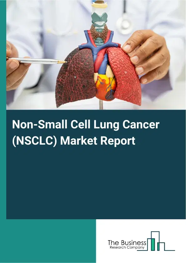 Global Non-Small Cell Lung Cancer (NSCLC) Market Report 2026 Global Non-Small Cell Lung Cancer (NSCLC) Market Report 2026