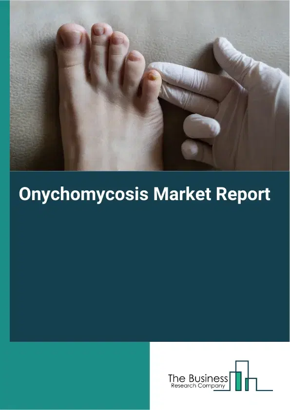 Global Onychomycosis Market Report 2026 Global Onychomycosis Market Report 2026