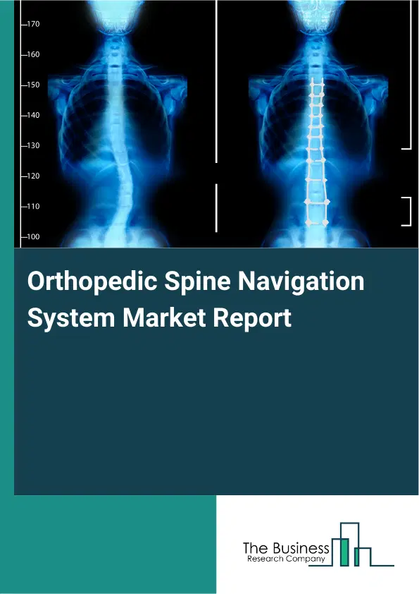 Global Orthopedic Spine Navigation System Market Report 2026 Global Orthopedic Spine Navigation System Market Report 2026