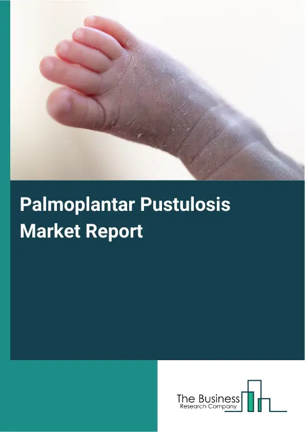 Global Palmoplantar Pustulosis Market Report 2026 Global Palmoplantar Pustulosis Market Report 2026