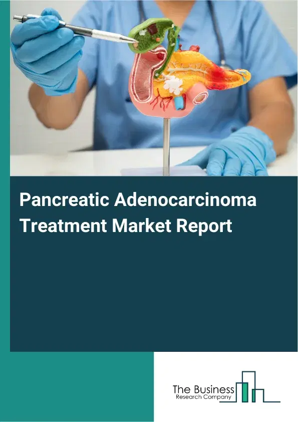 Global Pancreatic Adenocarcinoma Treatment Market Report 2026 Global Pancreatic Adenocarcinoma Treatment Market Report 2026