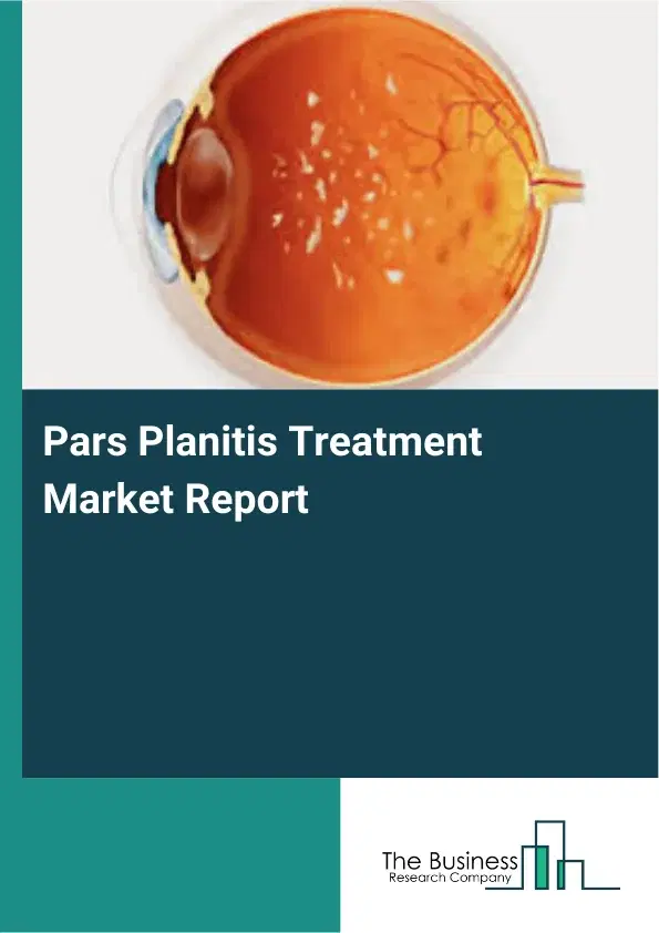 Global Pars Planitis Treatment Market Report 2026 Global Pars Planitis Treatment Market Report 2026