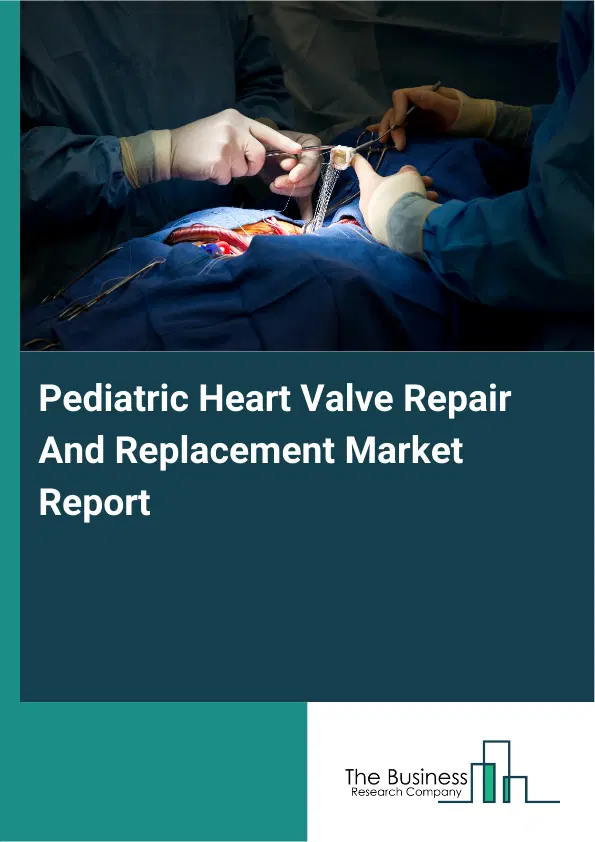 Global Pediatric Heart Valve Repair And Replacement Market Report 2026 Global Pediatric Heart Valve Repair And Replacement Market Report 2026