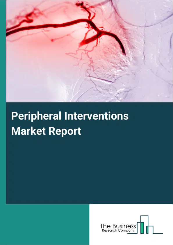 Global Peripheral Interventions Market Report 2026 Global Peripheral Interventions Market Report 2026