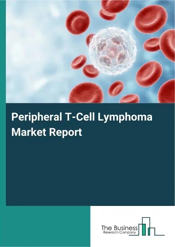 Global Peripheral T-Cell Lymphoma Market Report 2026 Global Peripheral T-Cell Lymphoma Market Report 2026