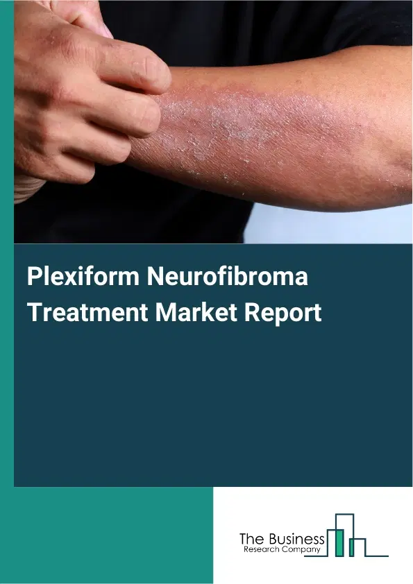 Global Plexiform Neurofibroma Treatment Market Report 2026 Global Plexiform Neurofibroma Treatment Market Report 2026