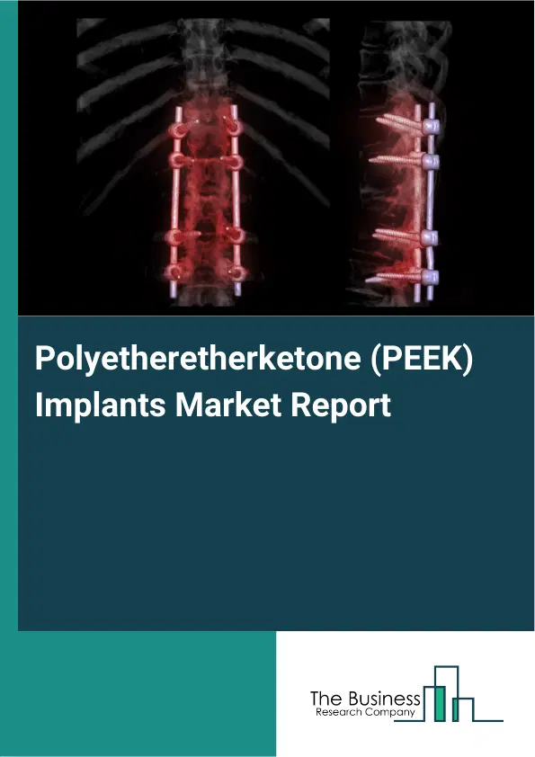 Global Polyetheretherketone (PEEK) Implants Market Report 2026 Global Polyetheretherketone (PEEK) Implants Market Report 2026