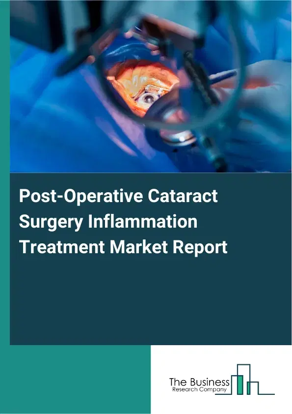 Global Post-Operative Cataract Surgery Inflammation Treatment Market Report 2026 Global Post-Operative Cataract Surgery Inflammation Treatment Market Report 2026