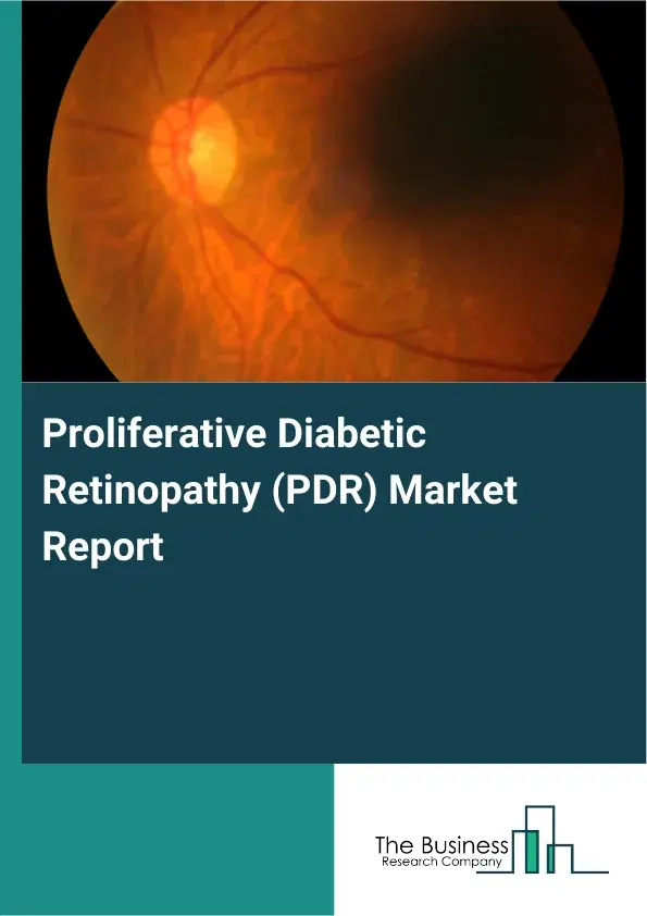 Global Proliferative Diabetic Retinopathy (PDR) Market Report 2026 Global Proliferative Diabetic Retinopathy (PDR) Market Report 2026