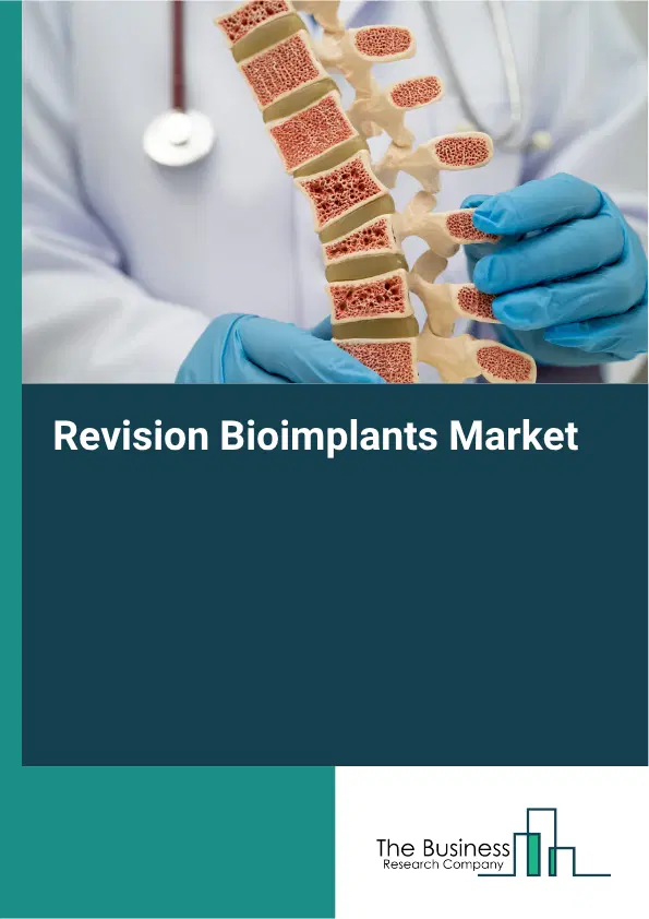 Revision Bioimplants Market Report 2026 Revision Bioimplants Market Report 2026