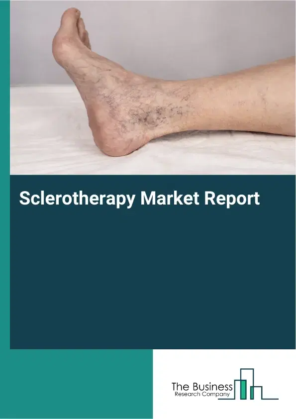 Global Sclerotherapy Market Report 2026 Global Sclerotherapy Market Report 2026