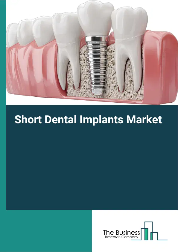 Short Dental Implants Market Report 2026 Short Dental Implants Market Report 2026
