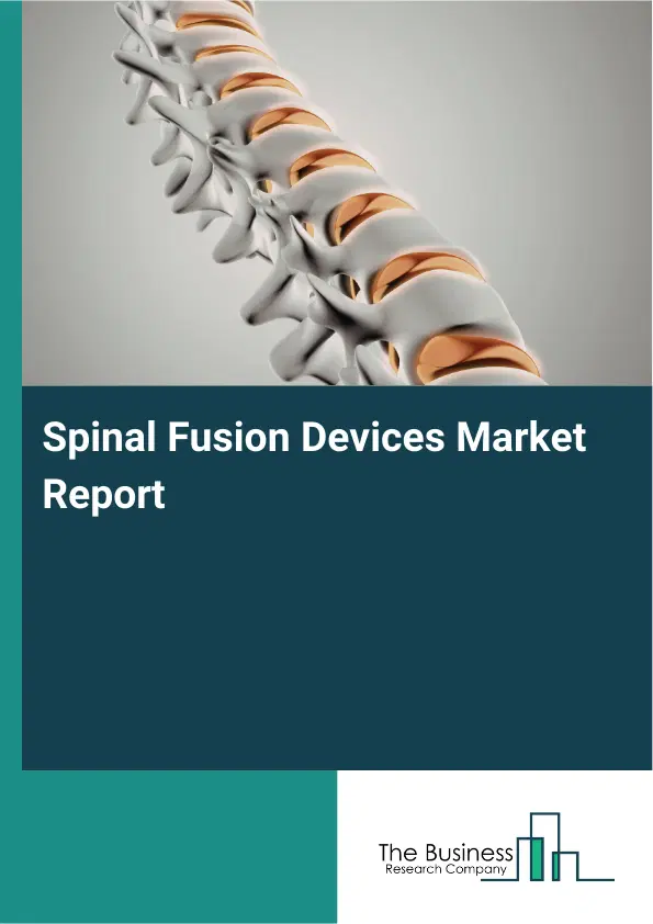 Global Spinal Fusion Devices Market Report 2026 Global Spinal Fusion Devices Market Report 2026