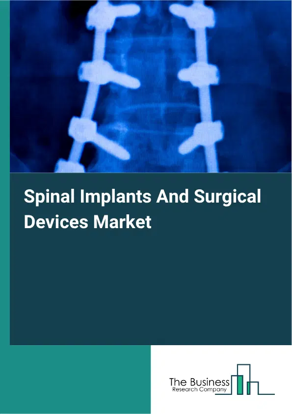 Spinal Implants And Surgical Devices Market Report 2026 Spinal Implants And Surgical Devices Market Report 2026