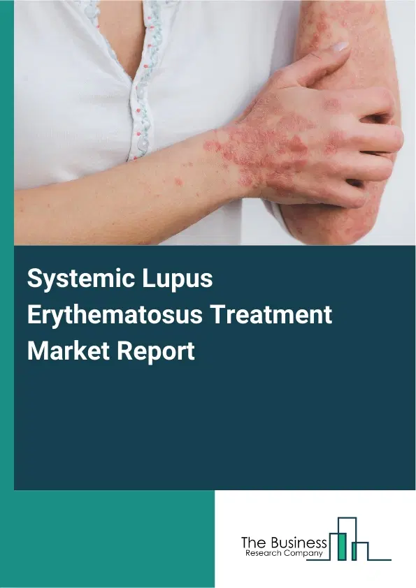 Global Systemic Lupus Erythematosus Treatment Market Report 2026 Global Systemic Lupus Erythematosus Treatment Market Report 2026