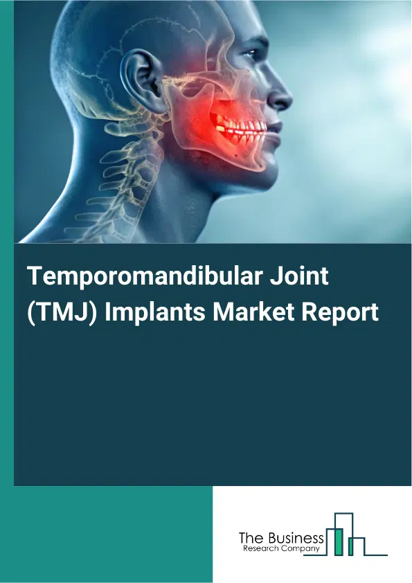 Global Temporomandibular Joint (TMJ) Implants Market Report 2026 Global Temporomandibular Joint (TMJ) Implants Market Report 2026