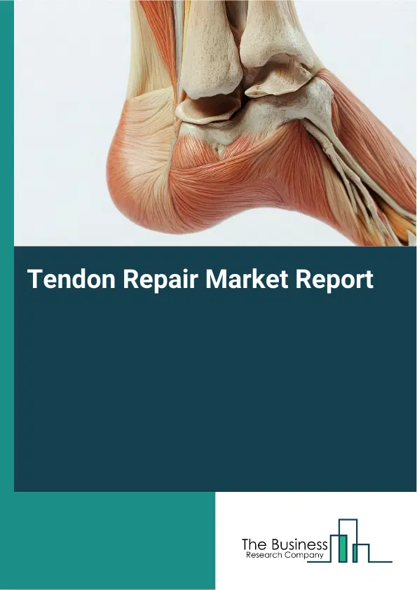 Global Tendon Repair Market Report 2026 Global Tendon Repair Market Report 2026