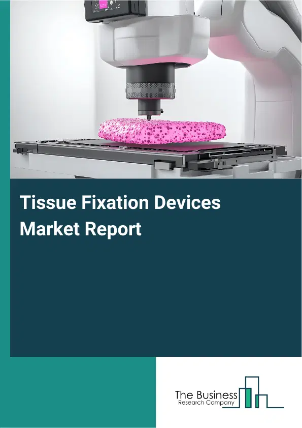 Global Tissue Fixation Devices Market Report 2026 Global Tissue Fixation Devices Market Report 2026