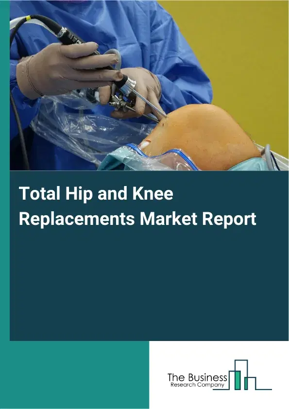 Global Total Hip and Knee Replacements Market Report 2026 Global Total Hip and Knee Replacements Market Report 2026