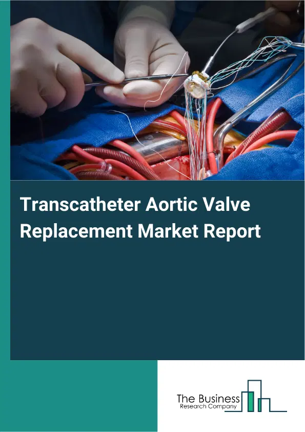 Transcatheter Aortic Valve Replacement Market Report 2026 Transcatheter Aortic Valve Replacement Market Report 2026