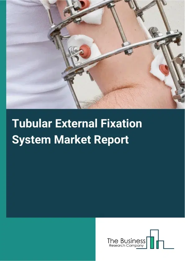 Global Tubular External Fixation System Market Report 2026 Global Tubular External Fixation System Market Report 2026