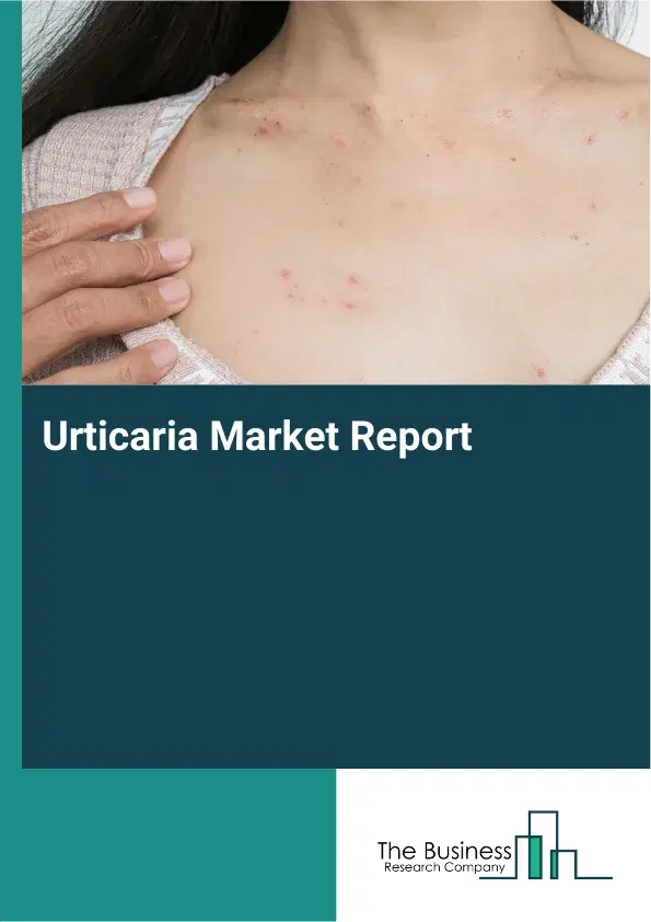 Global Urticaria Market Report 2026 Global Urticaria Market Report 2026
