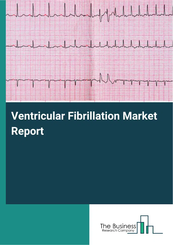 Global Ventricular Fibrillation Market Report 2026 Global Ventricular Fibrillation Market Report 2026