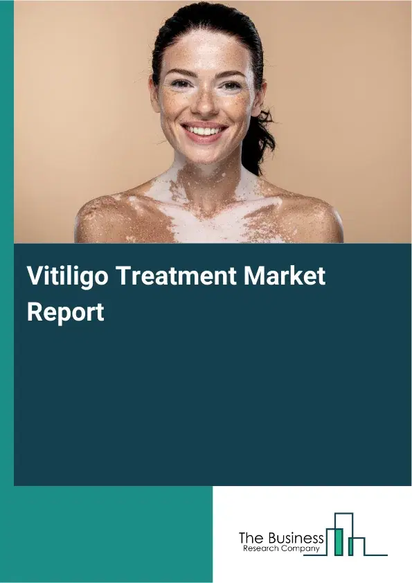 Global Vitiligo Treatment Market Report 2026 Global Vitiligo Treatment Market Report 2026