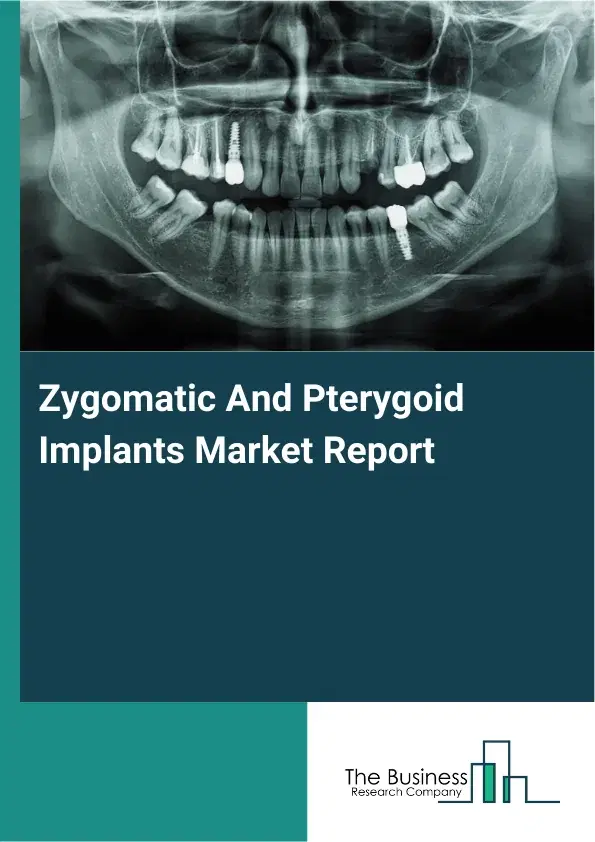 Global Zygomatic And Pterygoid Implants Market Report 2026 Global Zygomatic And Pterygoid Implants Market Report 2026