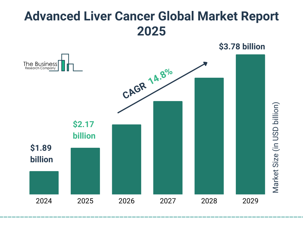 Advanced Liver Cancer Market Size and growth rate 2025 to 2029: Graph