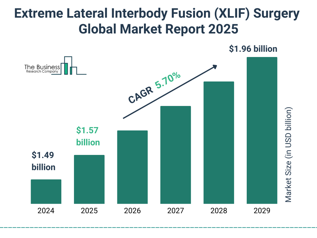 Extreme Lateral Interbody Fusion (XLIF) Surgery  Market Size and growth rate 2025 to 2029: Graph