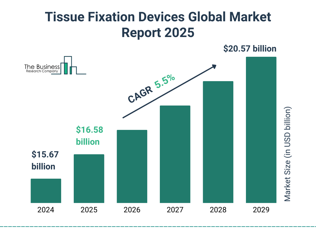 Tissue Fixation Devices Market Size and growth rate 2025 to 2029: Graph