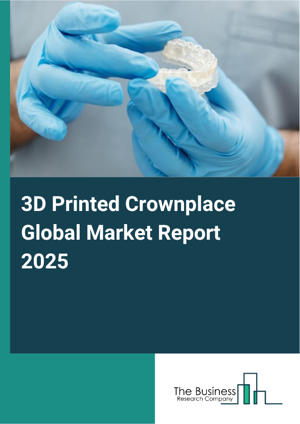 Global 3D Printed Crownplace Market Report 2025