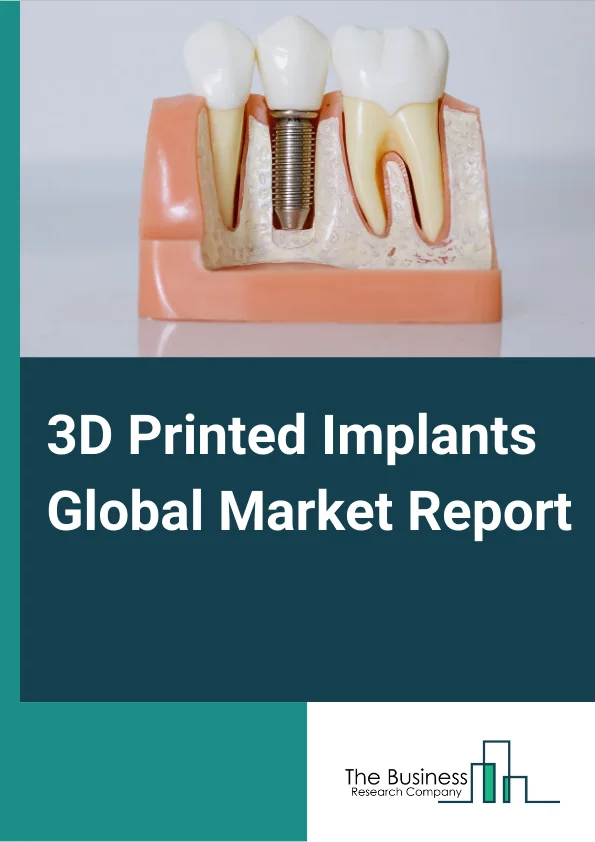3D Printed Implants Global Market Report 2024 – By Implantation Technology (Laser Beam Melting, Electronic Beam Melting, Droplet Deposition, Laminated Deposition, Two-photon Polymerization), By Application (Dental, Orthopedic, Cranio-maxillofacial), By End Users (Medical And Surgical Centers, Pharmaceutical Companies, Biotechnology Industry, Medical Institution) – Market Size, Trends, And Global Forecast 2024-2033