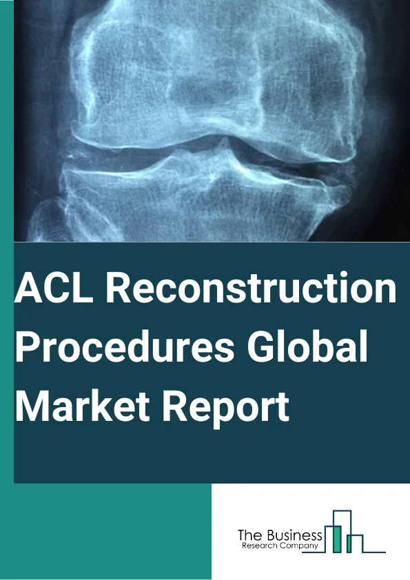 Global ACL Reconstruction Procedures Market Report 2024