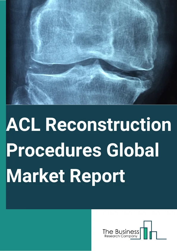 ACL Reconstruction Procedures Market Report 2025 ACL Reconstruction Procedures Market Trends
